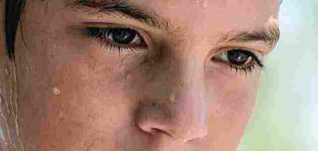 أسباب التعرق الزائد في الوجه والأمراض الناتجة عنه وكيفية جعل الوجه أكثر لمعاناً