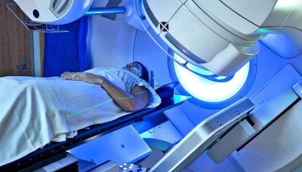 هل العلاج الإشعاعي يقضي على السرطان زيادة